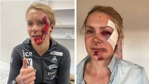 Brutto incidente in bici per Karoline Knotten: la biatleta norvegese si deve fermare